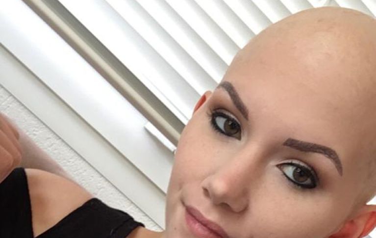 Das Bild zeigt Domenique mit einer Glatze, weil sie wegen der Chemeotherapie alle Haare verlor.
