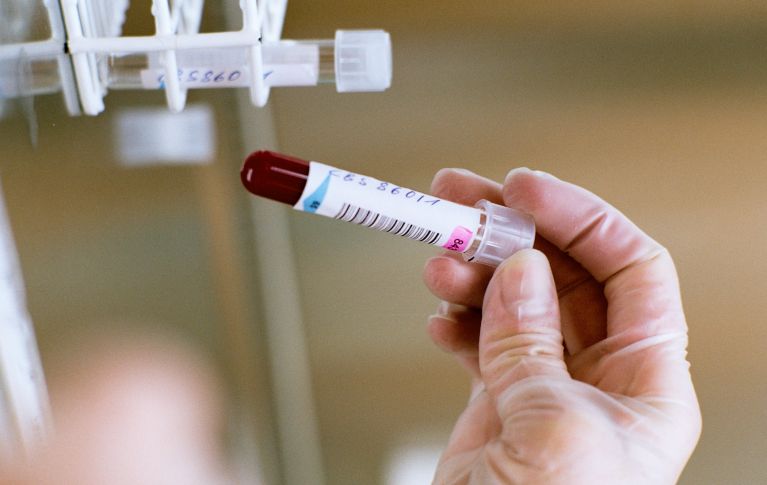 Medizinisches Fachpersonal hält ein Röhrchen mit entnommenem Blut zur Prüfung in der Hand