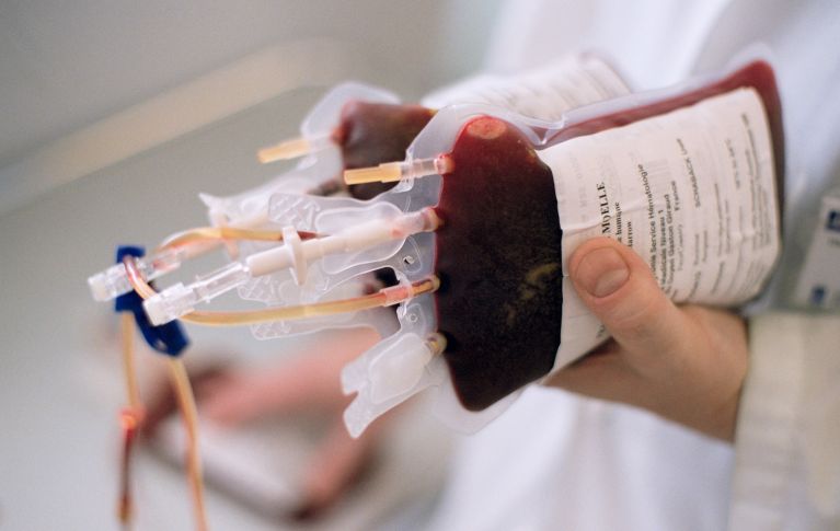 Il personale medico tiene in mano due sacche di cellule staminali del sangue raccolte.