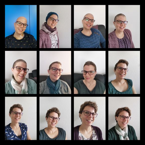 12 Porträt von Myriamm auf denen man ihre Veränderung von der Spende bis zu einem Jahr danach sieht